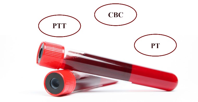 آزمایش خون قبل از جراحی بینی PTT PT CBC