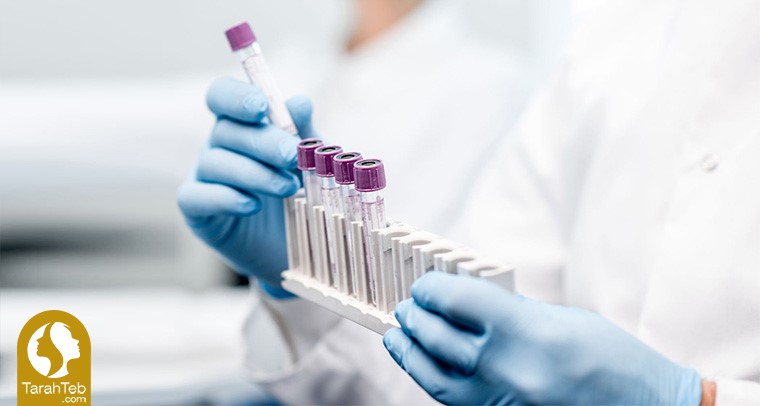 آزمایش‌های قبل از عمل بینی