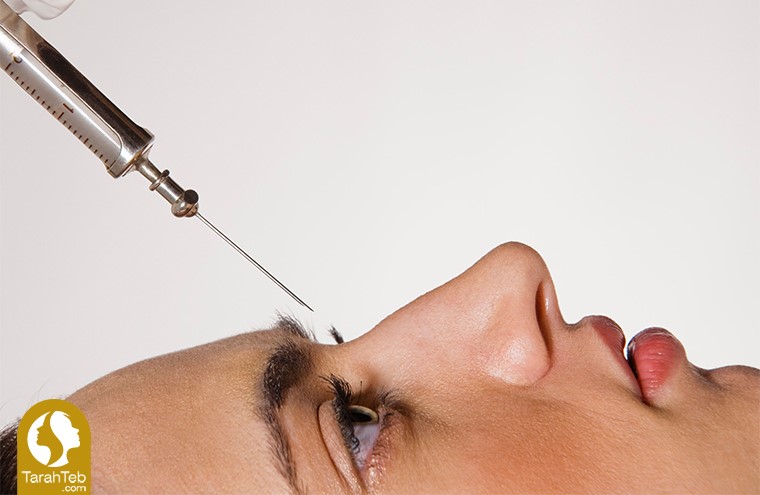 برداشتن قوز بینی با روش‌های غیر از جراحی زیبایی