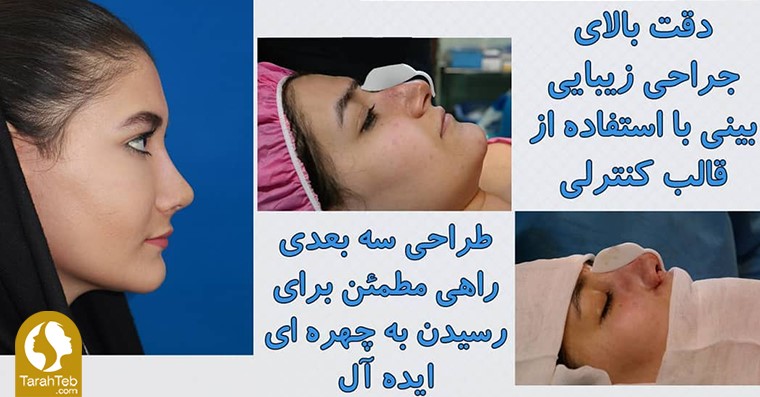 تصمیم‌گیری برای تغییر شکل بینی