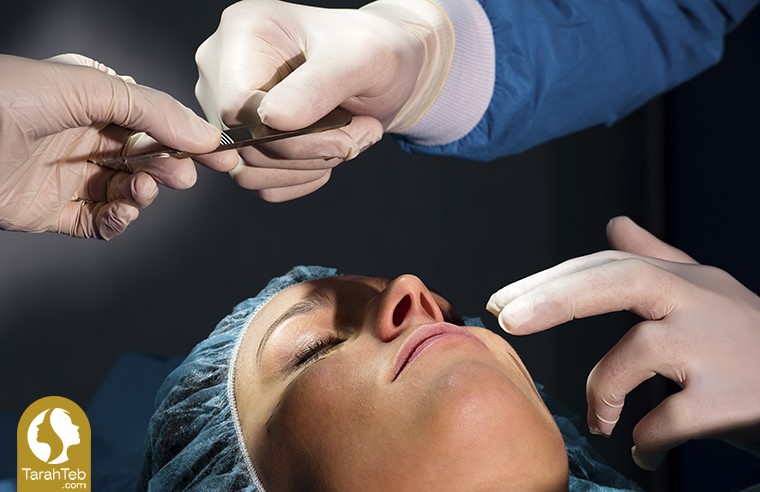 جراحی شاخک‌های بینی برای درمان گرفتگی بینی