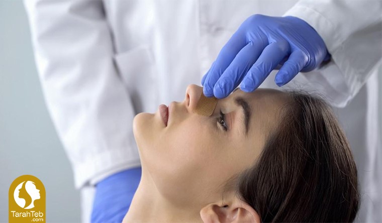 روش‌های عمل جراحی بینی 