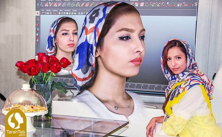 قدم سوم مشاوره‌ی عمل بینی در طراح طب