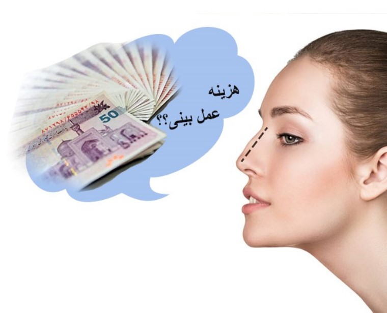 مقدار هزینه عمل بینی