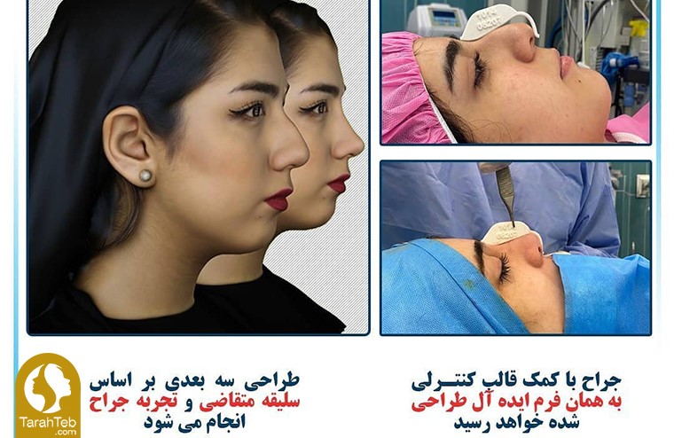 نتیجه‌ی جراحی کوچک کردن بینی