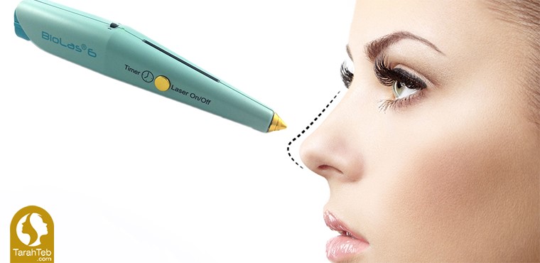 نحوه‌ی عمل بینی با لیزر