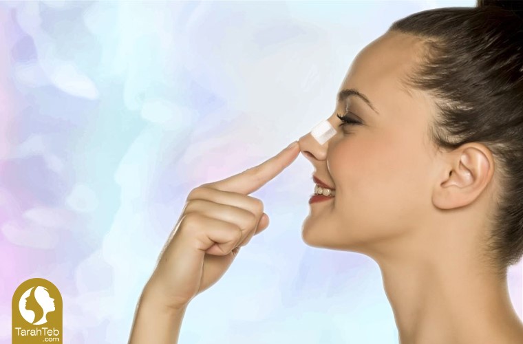 نحوه‌ی مراقبت از بینی بعد از عمل
