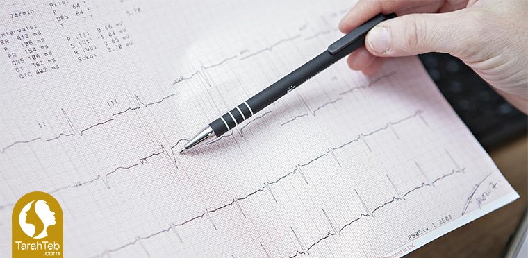 نوار قلب قبل از جراحی بینی