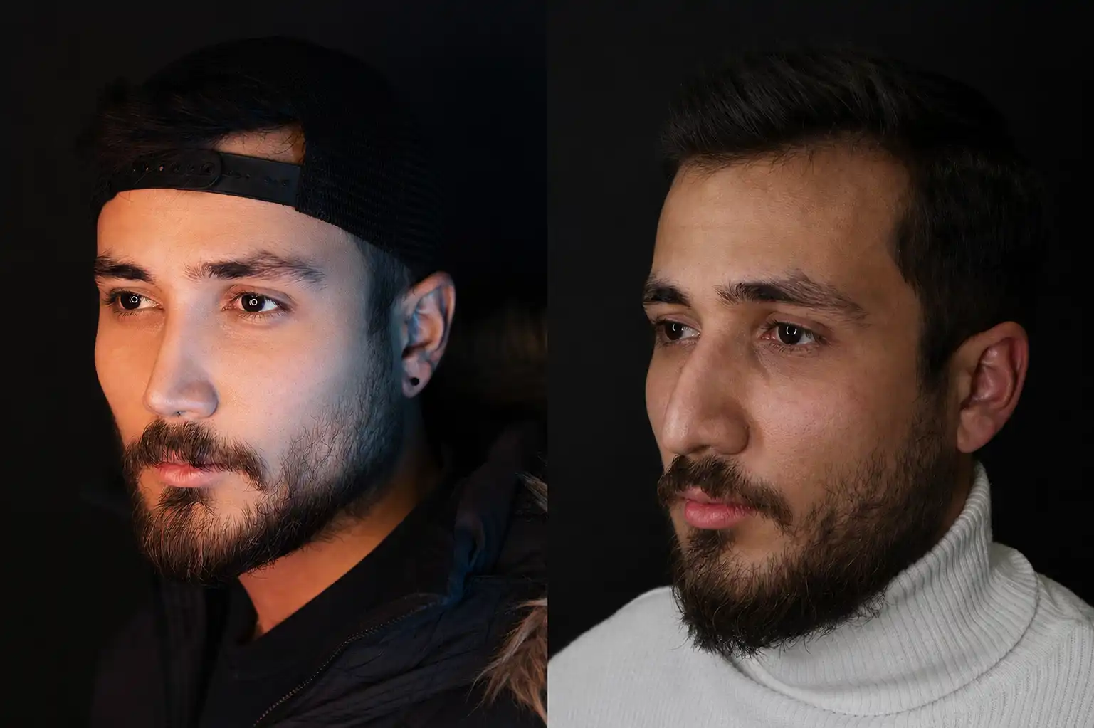 نمونه قبل و بعد عمل بینی شماره 27 - تصویر 1