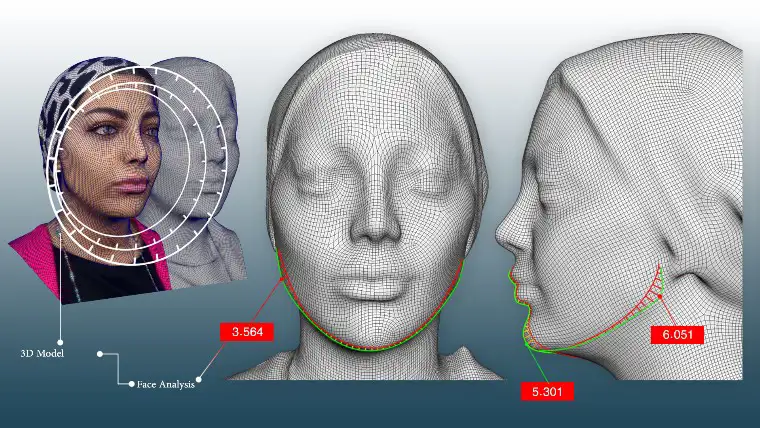 Three-dimensional design for gel and Botox injection