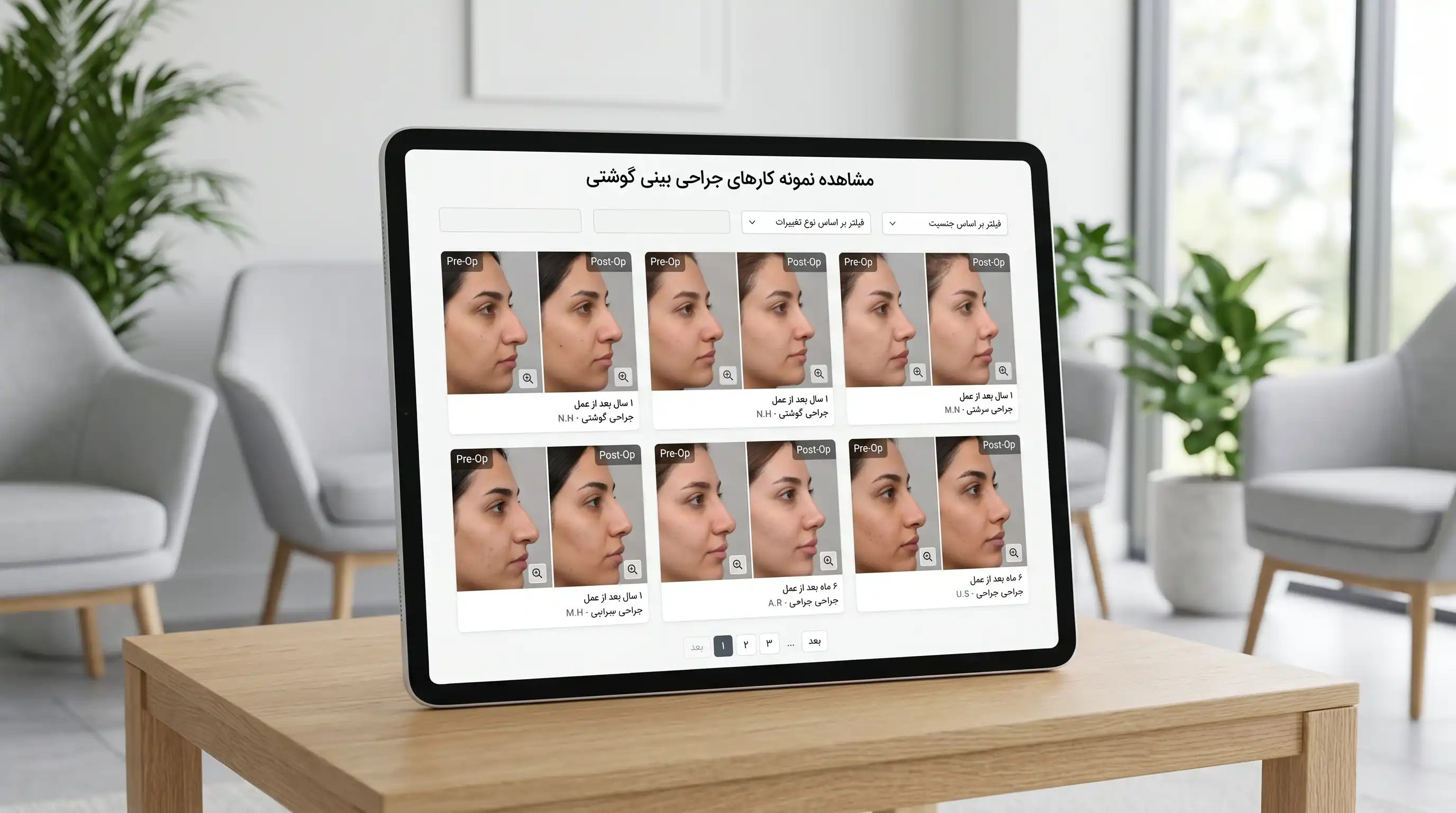 عکس قبل و بعد عمل بینی گوشتی، چه نتیجه‌ای واقع‌بینانه است؟