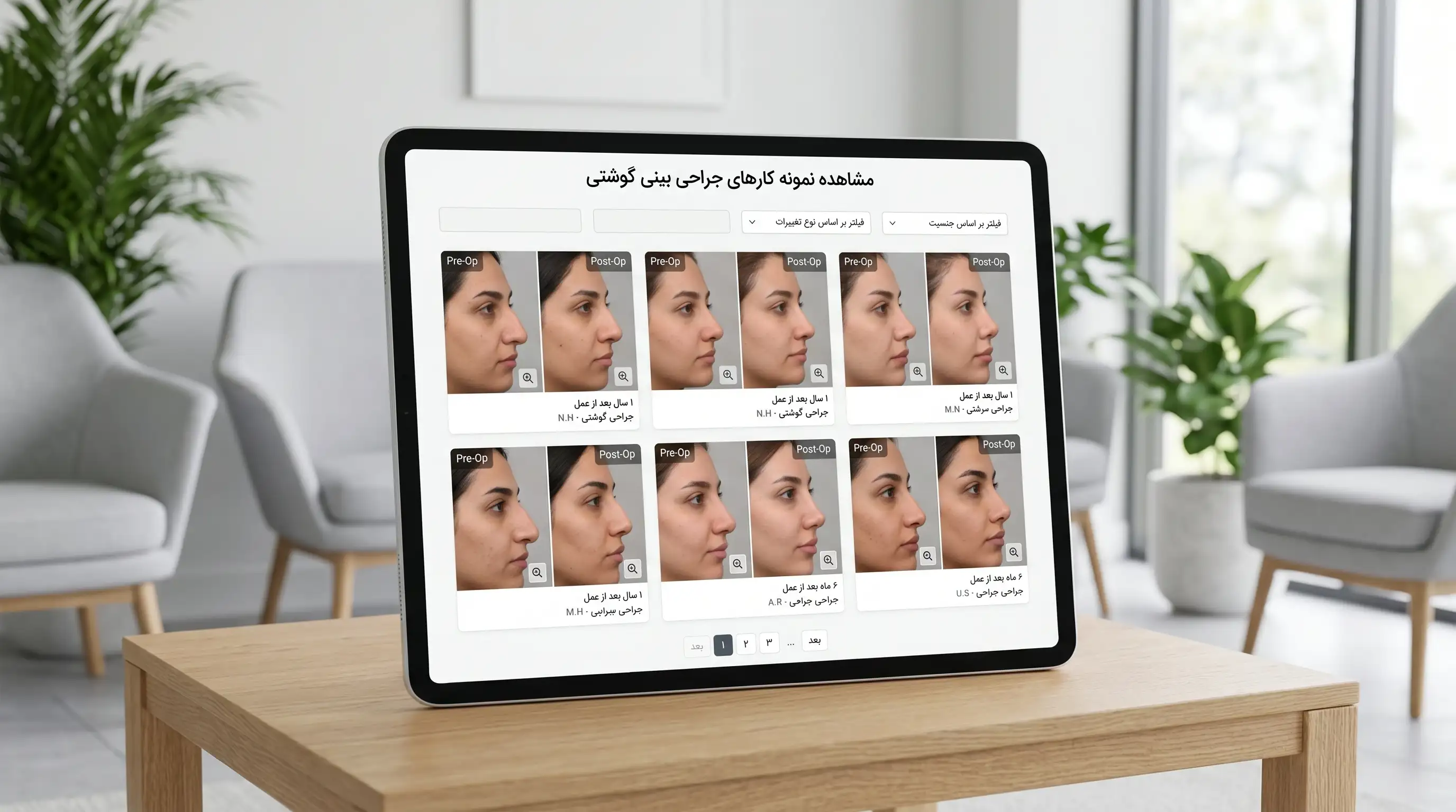 عکس قبل و بعد عمل بینی گوشتی، چه نتیجه‌ای واقع‌بینانه است؟
