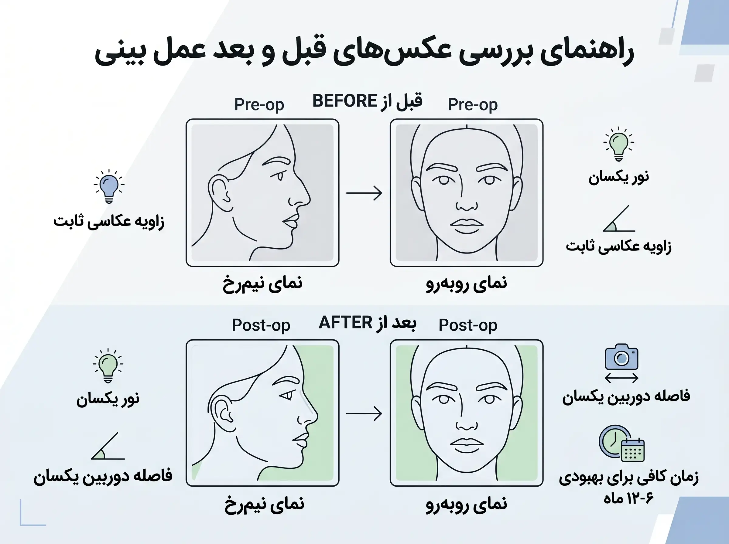 راهنمای بررسی عکس قبل و بعد عمل بینی با زاویه و نور مشابه