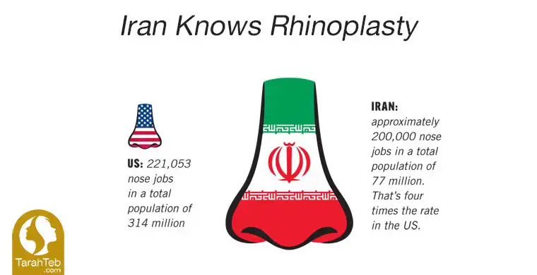 rhinoplasty in iran