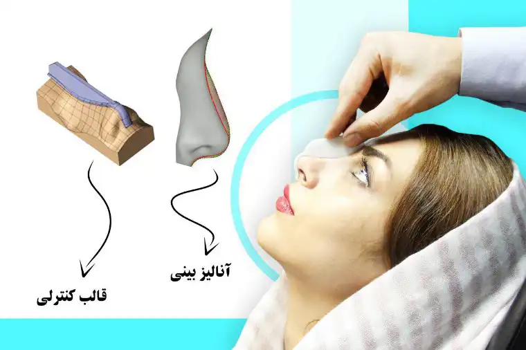 آنالیز سه بعدی صورت