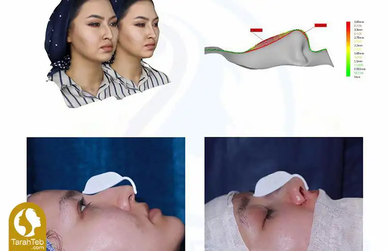 استفاده از تکنولوژی توسط بهترین جراح بینی