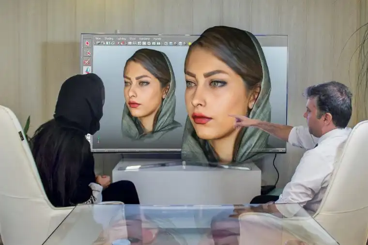 اسکن سه بعدی در تزریق ژل و بوتاکس