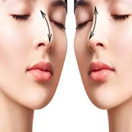 اصلاح مشکل تنفسی با عمل زیبایی بینی