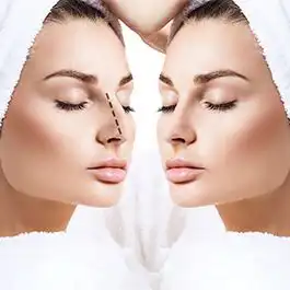 برداشتن قوز بینی