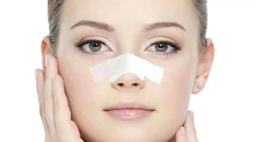 بهترین سن عمل بینی حداقل و حداکثر سن جراحی بینی