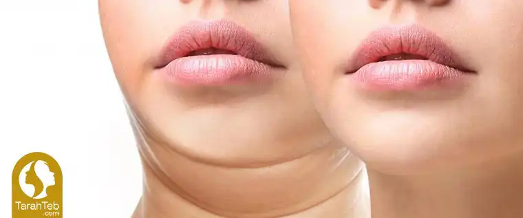 تغییر وزن زیبایی چهره