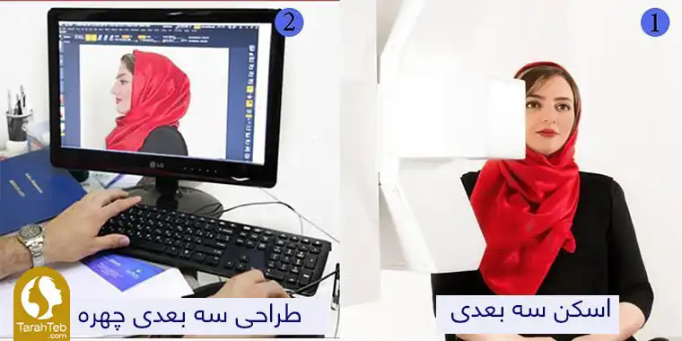 تغییرات بینی بعد از عمل بینی