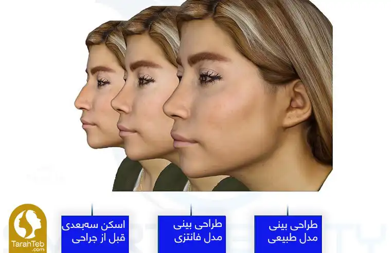 تناسب بینی نیمه فانتزی با صورت