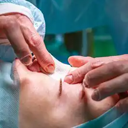 تکنیک جدید عمل زیبایی بینی حفاظت کننده
