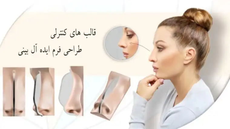 جراحی بینی به کمک قالب بینی