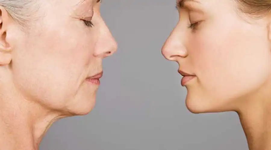 جراحی بینی در افراد مسن
