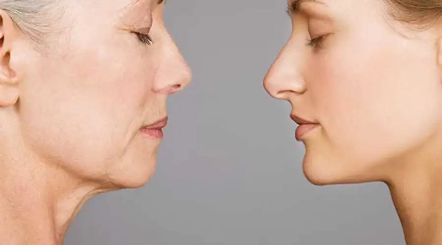 جراحی بینی در افراد مسن