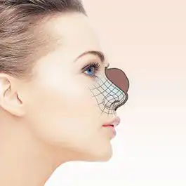 جراحی زیبایی بینی