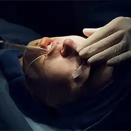 داستان جراحی بینی ژولن