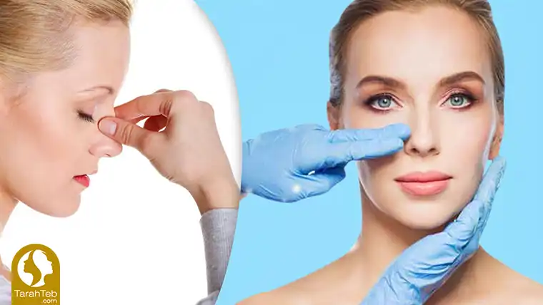 راهکار های کاهش عوارض جراحی بینی