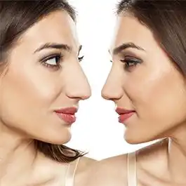 روش‌های کوچک کردن بینی