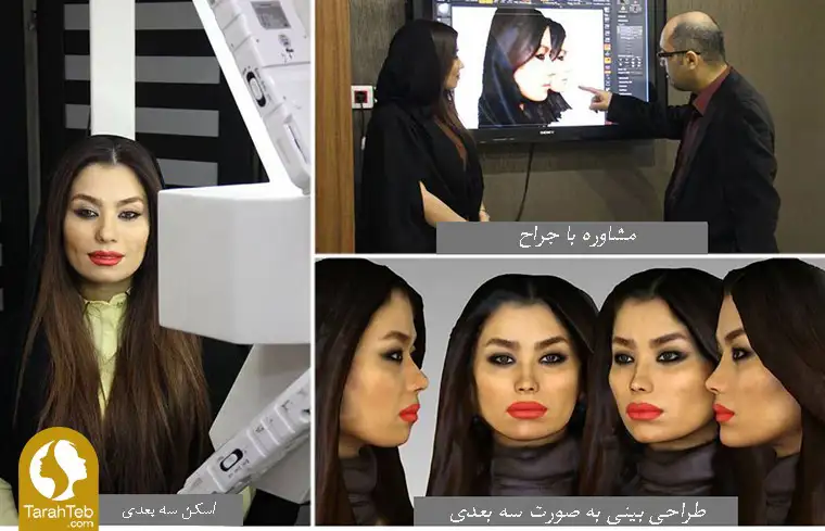 طراحی سه بعدی بینی برای عمل ترمیمی