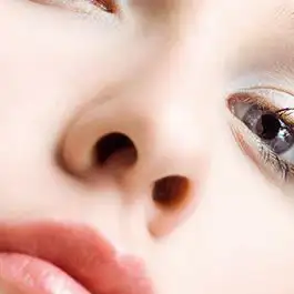 عدم تقارن سوراخ های بینی