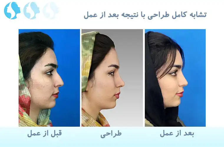 عمل بینی طبیعی و طراحی سه بعدی