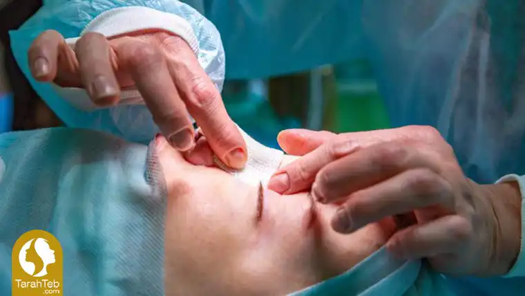 عمل زیبایی بینی حفاظت کننده