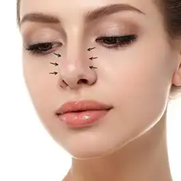 عمل زیبایی بینی پهن