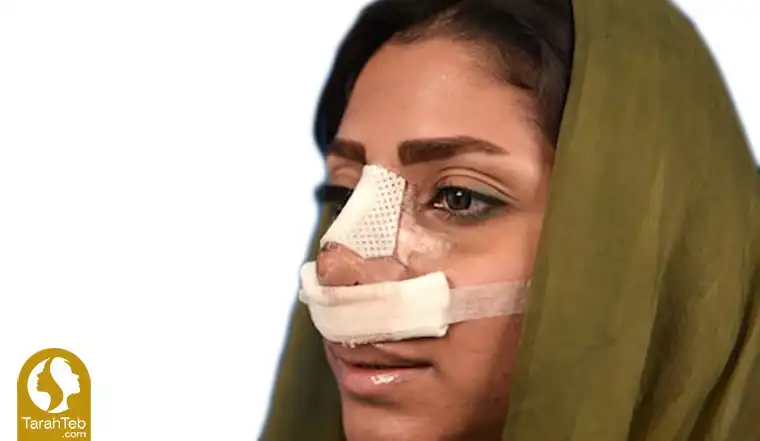 عوارض عمل بینی