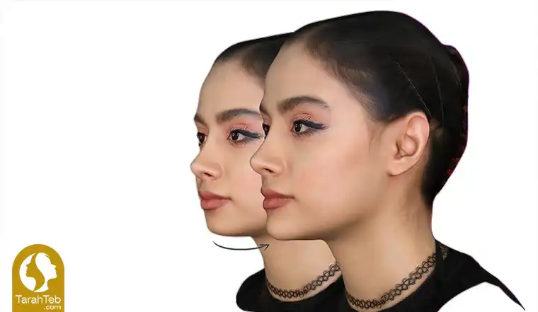 عکس برداری سه بعدی قبل از عمل زیبایی