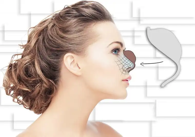 قالب بینی طراح طب