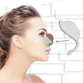 قالب کنترلی و روش اجرای آن