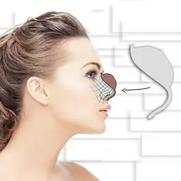 قالب کنترلی و روش اجرای آن