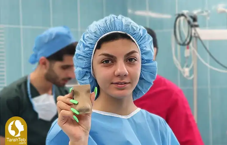 مدل بینی گوشتی