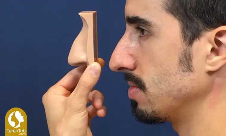 مشکلات افتادگی بینی