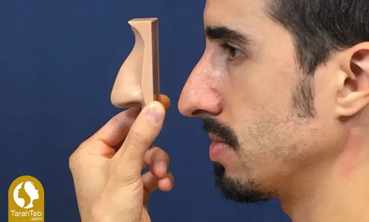 مشکلات افتادگی بینی