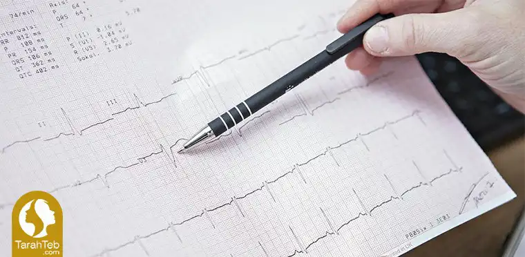 نوار قلب قبل از جراحی بینی