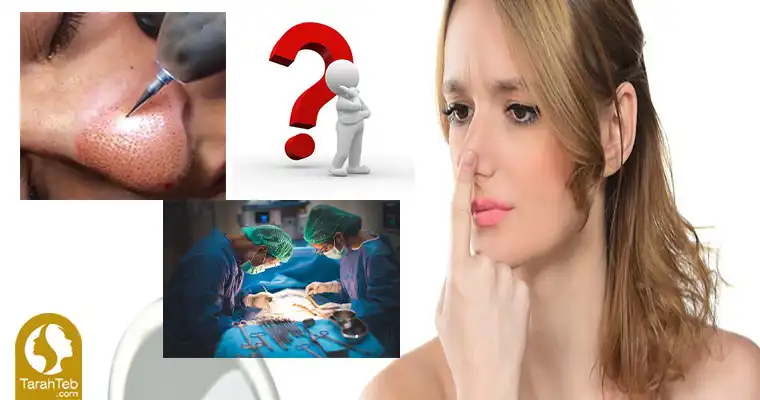 پلاسماجت عمل بینی